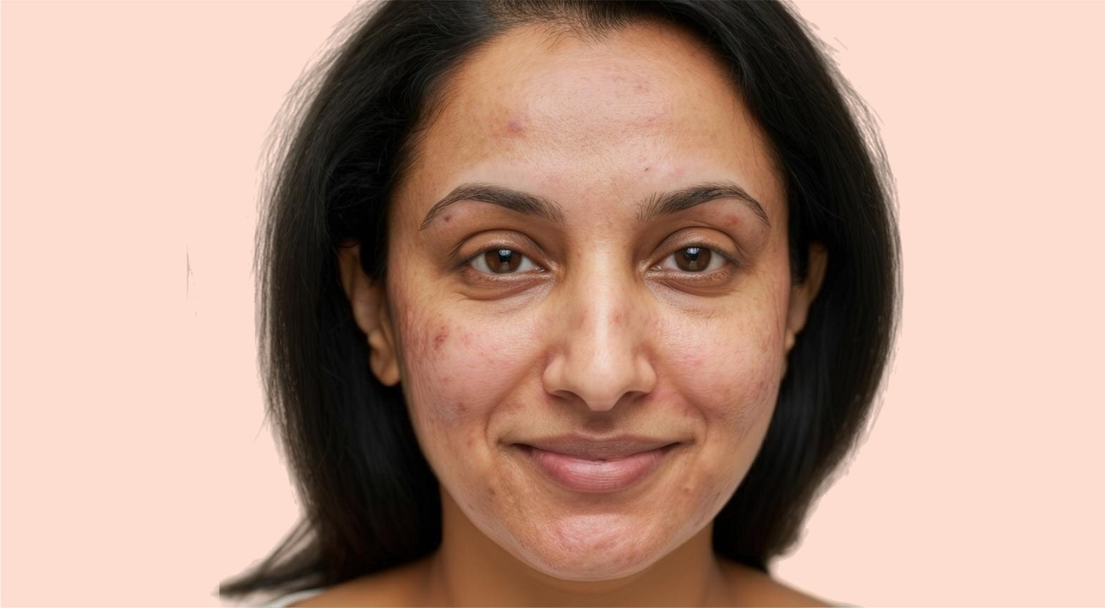 Before Treatment